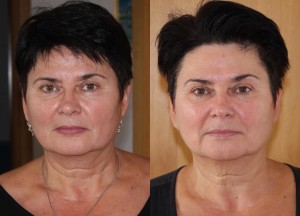 &mcy;&acy;&scy;&scy;&acy;&zhcy; &lcy;&icy;&tscy;&acy; &ecy;&fcy;&fcy;&iecy;&kcy;&tcy;&icy;&vcy;&ncy;&ocy;&scy;&tcy;&softcy;